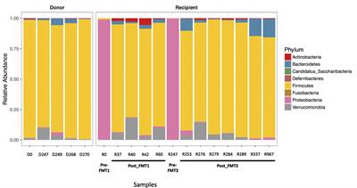 Changes in Composition of the Gut Bacterial Microbiome after Fecal Microbiota Transplantation for Recurrent Clostridium difficile Infection in a Pediatric Heart Transplant Patient